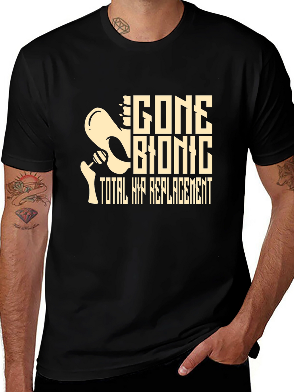 Gone Bionic Total Hip Replacement Graphic Tee