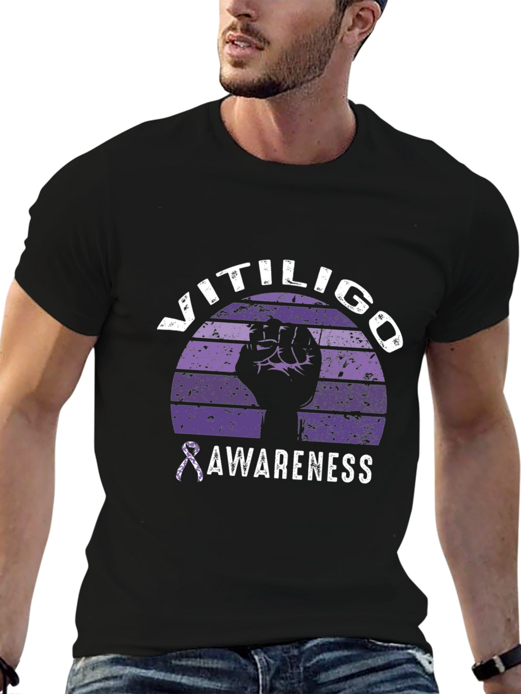 Vitiligo Awareness Graphic Tee