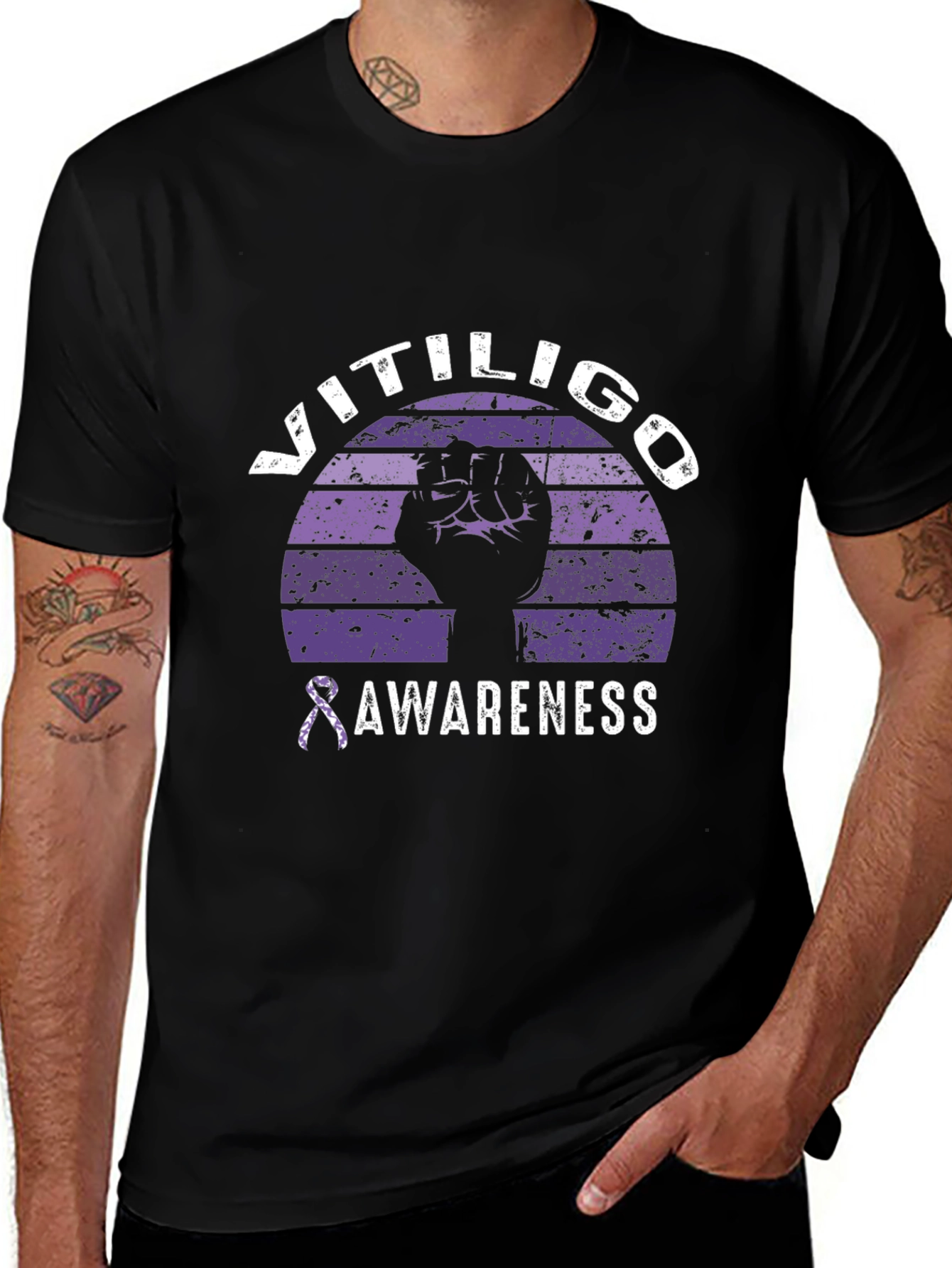 Vitiligo Awareness Graphic Tee