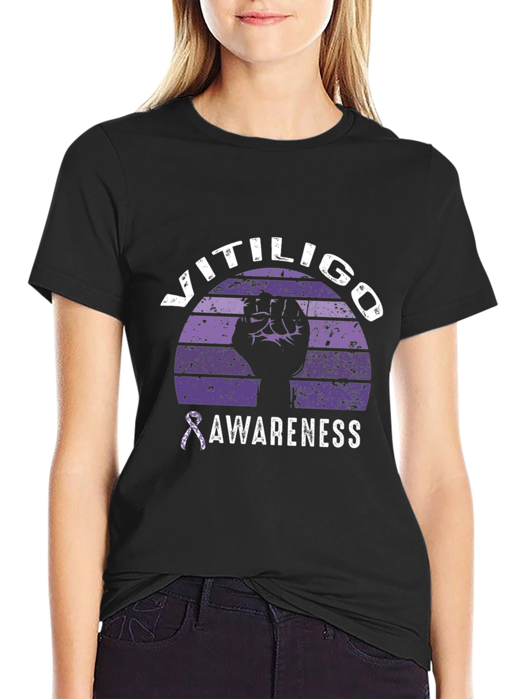 Vitiligo Awareness Graphic Tee
