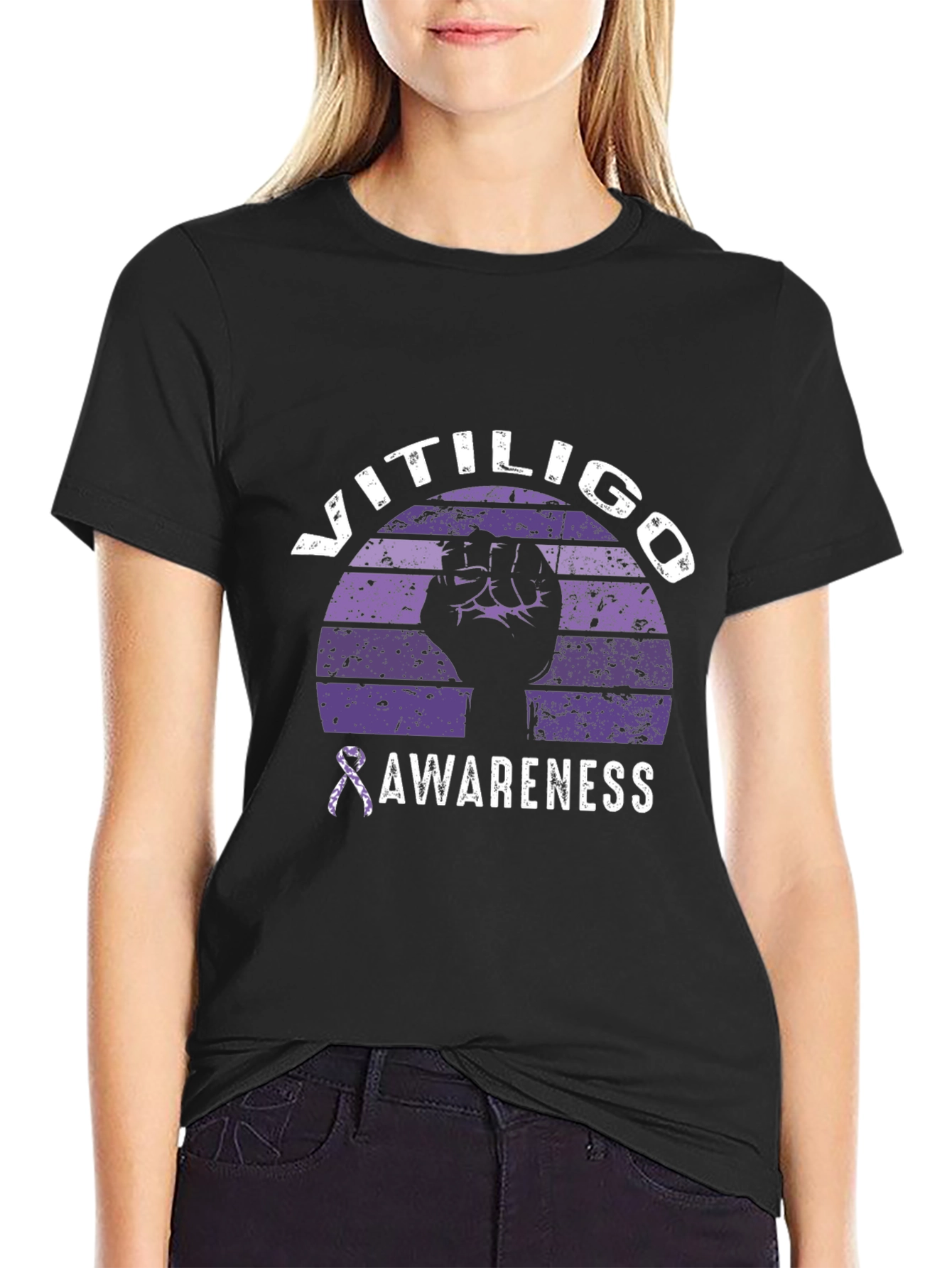 Vitiligo Awareness Graphic Tee