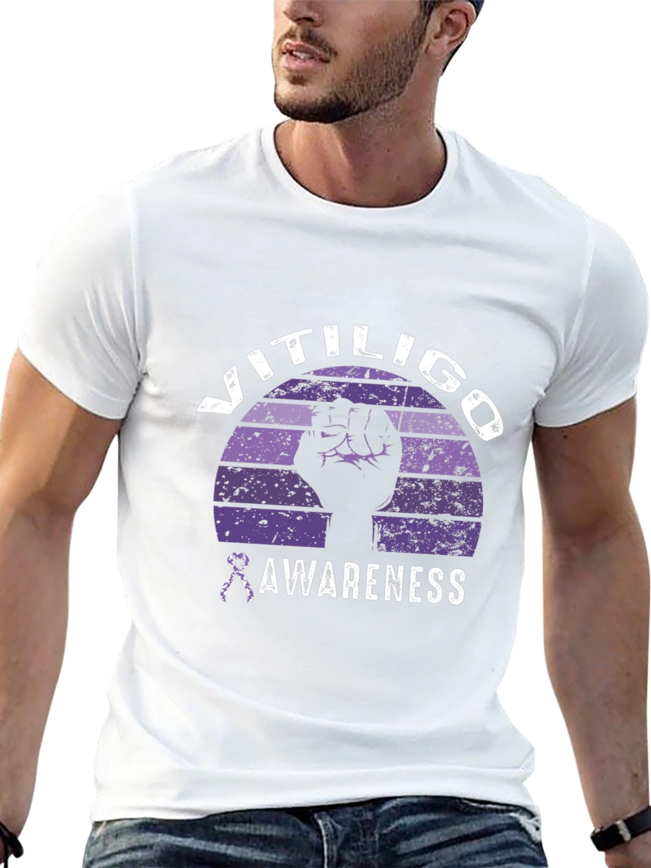 Vitiligo Awareness Graphic Tee