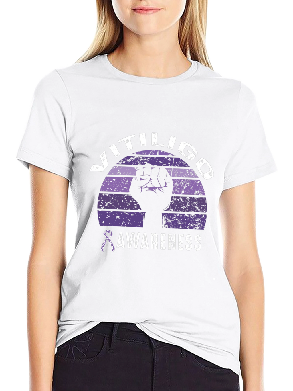 Vitiligo Awareness Graphic Tee