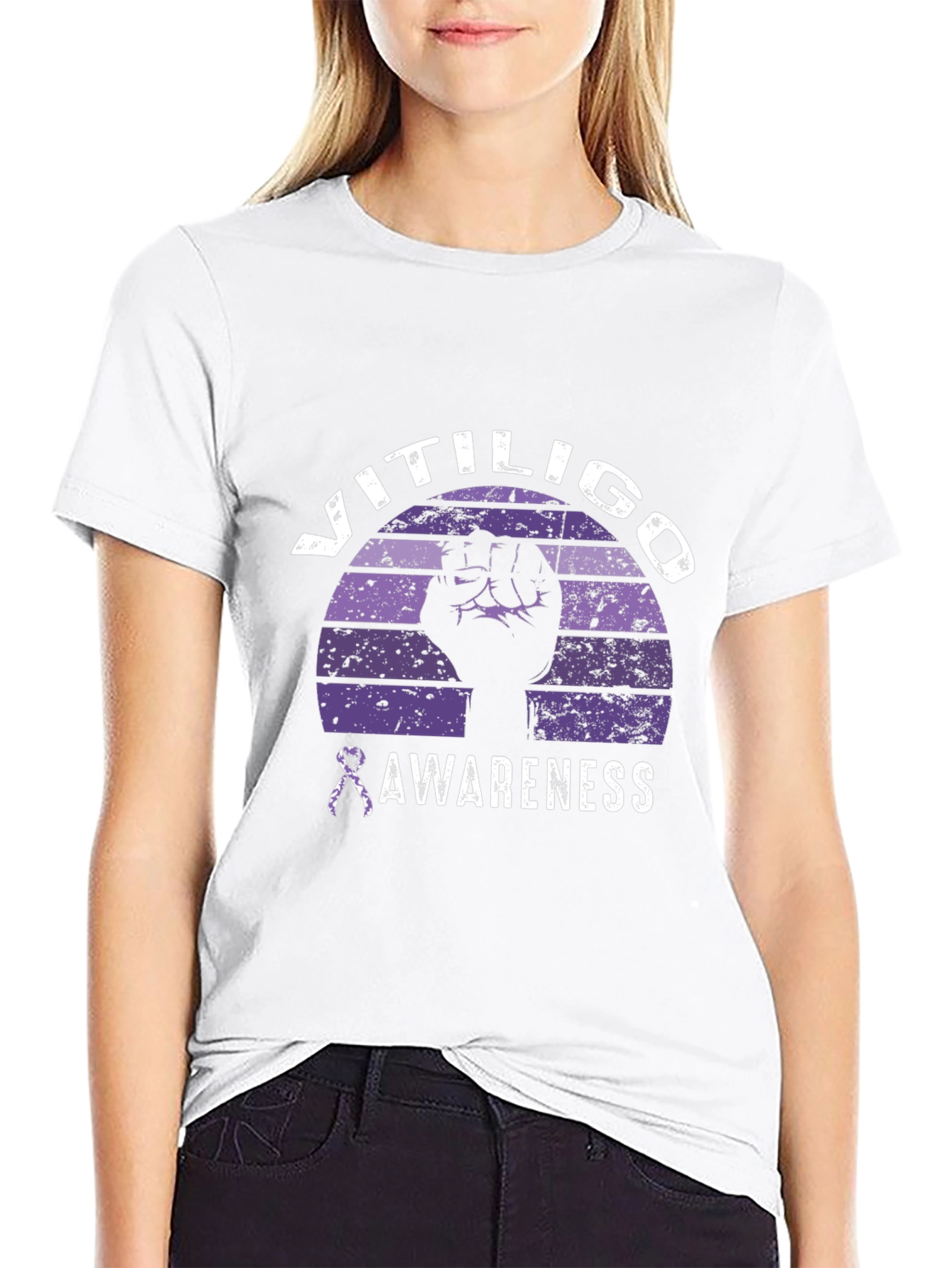 Vitiligo Awareness Graphic Tee