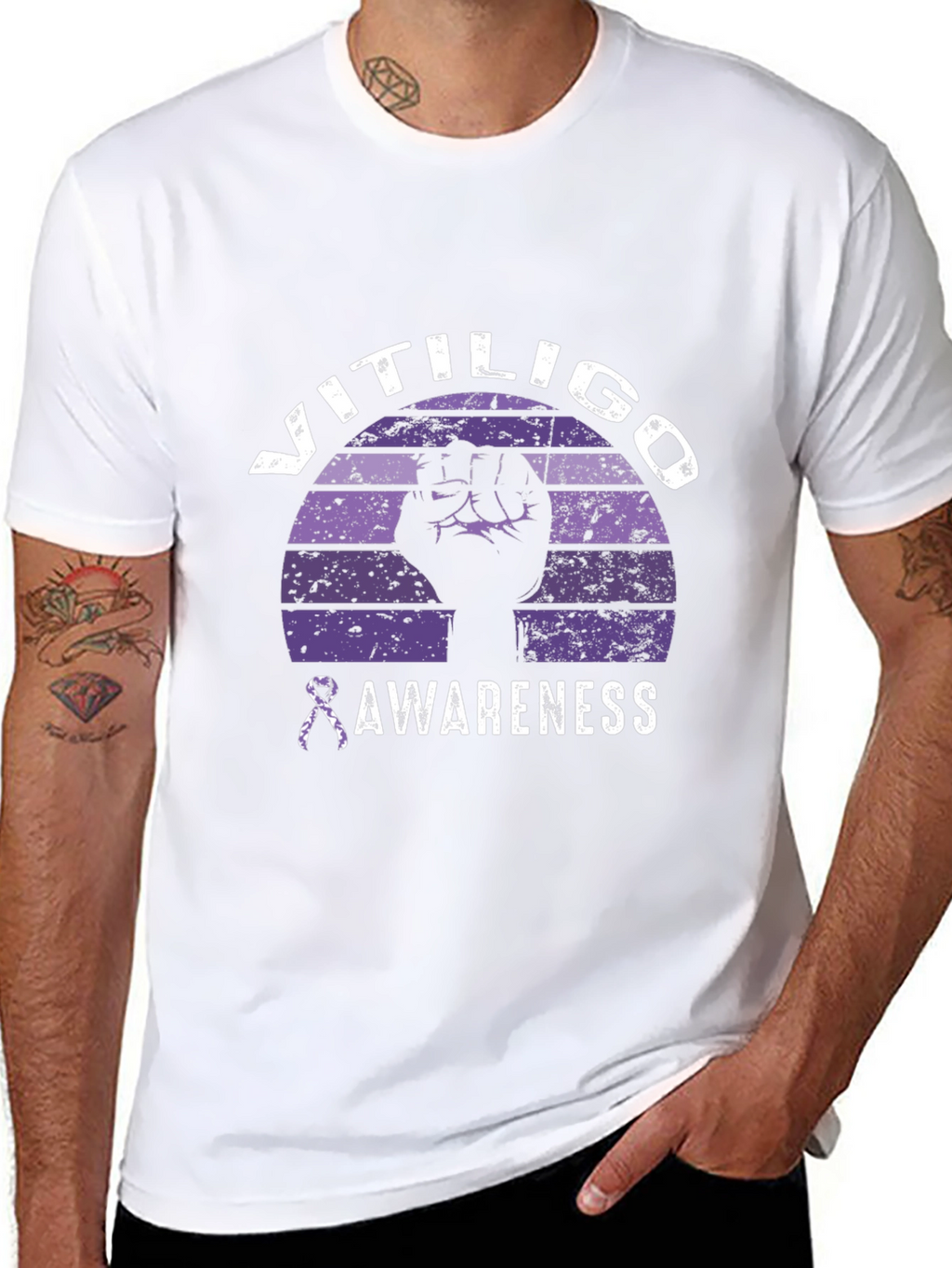 Vitiligo Awareness Graphic Tee
